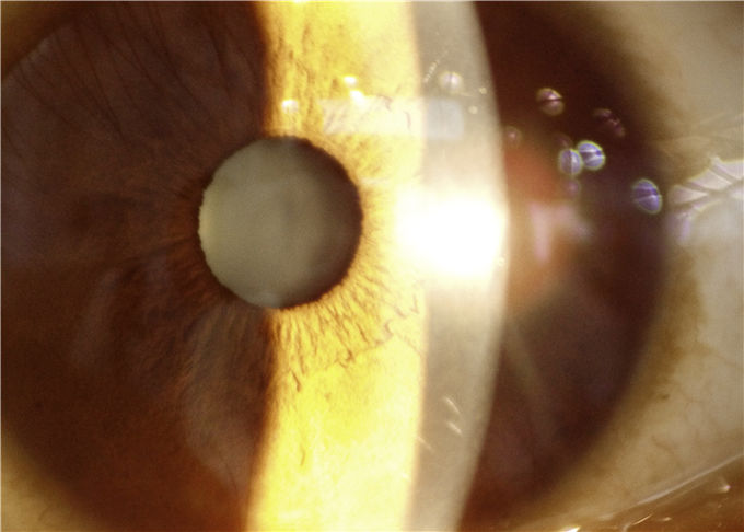 Fernmedizin-Anwendungs-Augenheilkunde-Gerät-tragbare Spaltlampe mit aufgeschlitzter Breite 0-12mm ununterbrochen justierbar