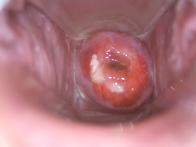 Der vagina in kamera Vulvovaginal Health