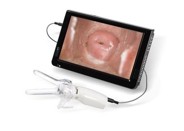 Minicolposcope für zervikale vaginale Kamera Examintion angeschlossen an Fernsehen oder PC