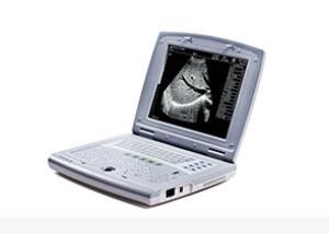 Tragbare Baby-Ultraschall-Maschinen-tragbarer Ultraschall-Scanner für Kinderheilkunde