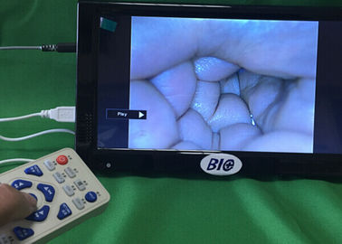 Videoausgang-Colposcope-Gynäkologie-Kamera voll Digital elektronische mit Gebrauchsanleitung