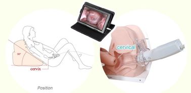 Elektronischer Colposcope Gesundheitswesen-Produkt-steuern gynäkologischer endoskopischer Digital für Frauen Gebrauch automatisch an