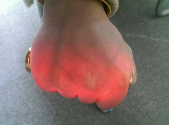 Tragbares Gefäßader-Sucher-Ader-Verzeichnis-goldenes Aluminium projektor Venipuncture Infrarot