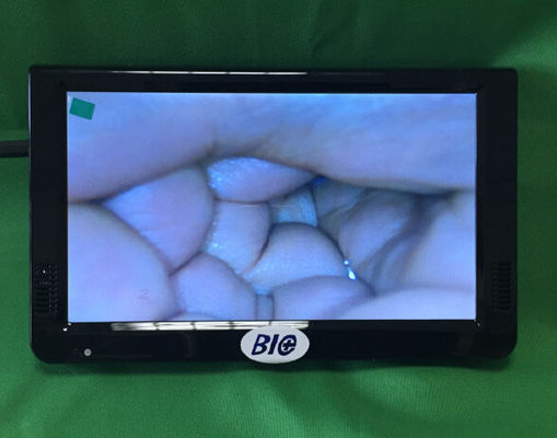 Tragbares digitales elektronisches Kolposkop