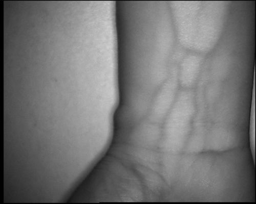 Tabellen-Art Ader-Verzeichnis-Gerät der hohen Auflösung 800X480 mit Schirm 3.5Inch für Handarm-Bein