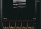 Farb-Doppler-Taschen-Ultraschall-Scanner-Anwendung für MSK-Brust-Schilddrüse