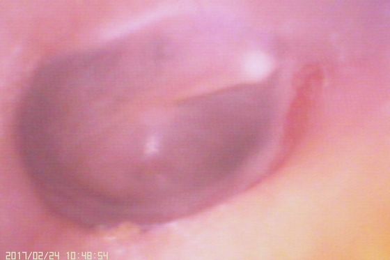 720X480 Digital Video Otoskop