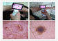 Klinische HNOinspektion von menschlicher Körper-Digital-Videootoscope mit Otoscope Farbe-TFT LCDs USB