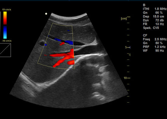 15 Zoll volle Digital-Farb-Doppler-Maschinen-tragbarer Doppler-Darstellungs-Ultraschall mit USB-Port 2