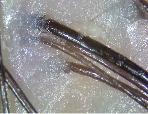 Tragbares drahtloses Digital-Haut-Analysator-Fernmedizin-Diagnosen-Gerät mit polarisieren Licht