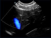 Mini Taschenhandheld Ultraschall-Scanner