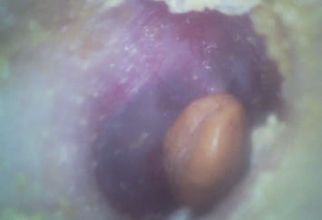 Tragbarer HNO- Bereich-wirtschaftlicher Hand-Digital-Videootoscope mit Mikro-Sd-Flash-Karte von 32G