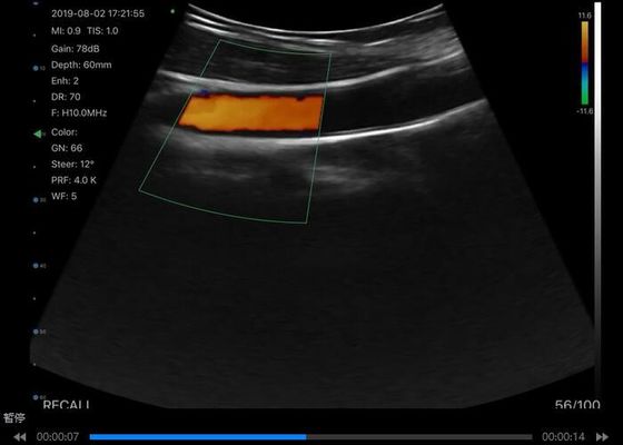 Digitaler drahtloser Hand-Ultraschallscanner