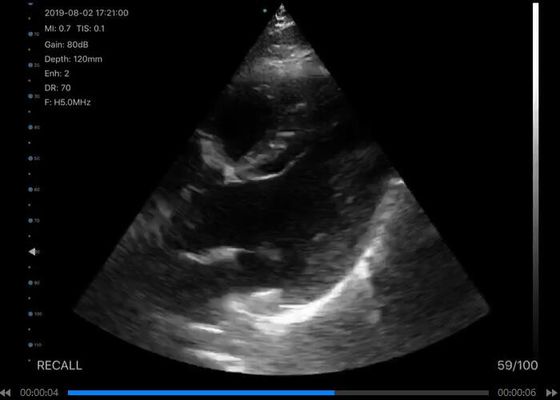 Digitaler drahtloser Hand-Ultraschallscanner