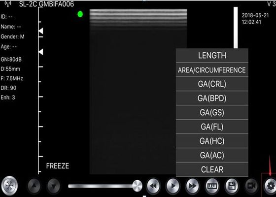 Handscanner-konvexer Körper des ultraschall-5G: 3.5~5MHz, linear: 7.5~10MHz, Herz: 2.5~5MHz