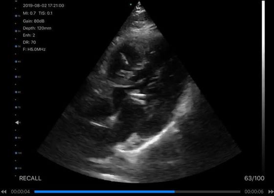 Handscanner-konvexer Körper des ultraschall-5G: 3.5~5MHz, linear: 7.5~10MHz, Herz: 2.5~5MHz