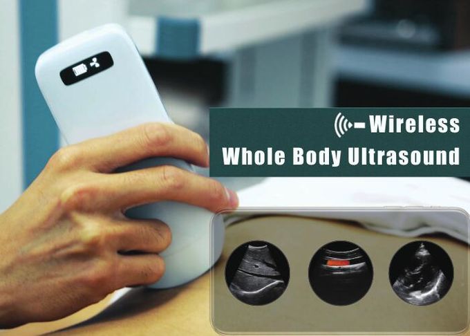 5G Wifi drahtloses Ladegerät der Handstützte ultraschall-Scanner-Taschen-Ultraschall-eingebauten Lithium-Batterie-4200mAh 1