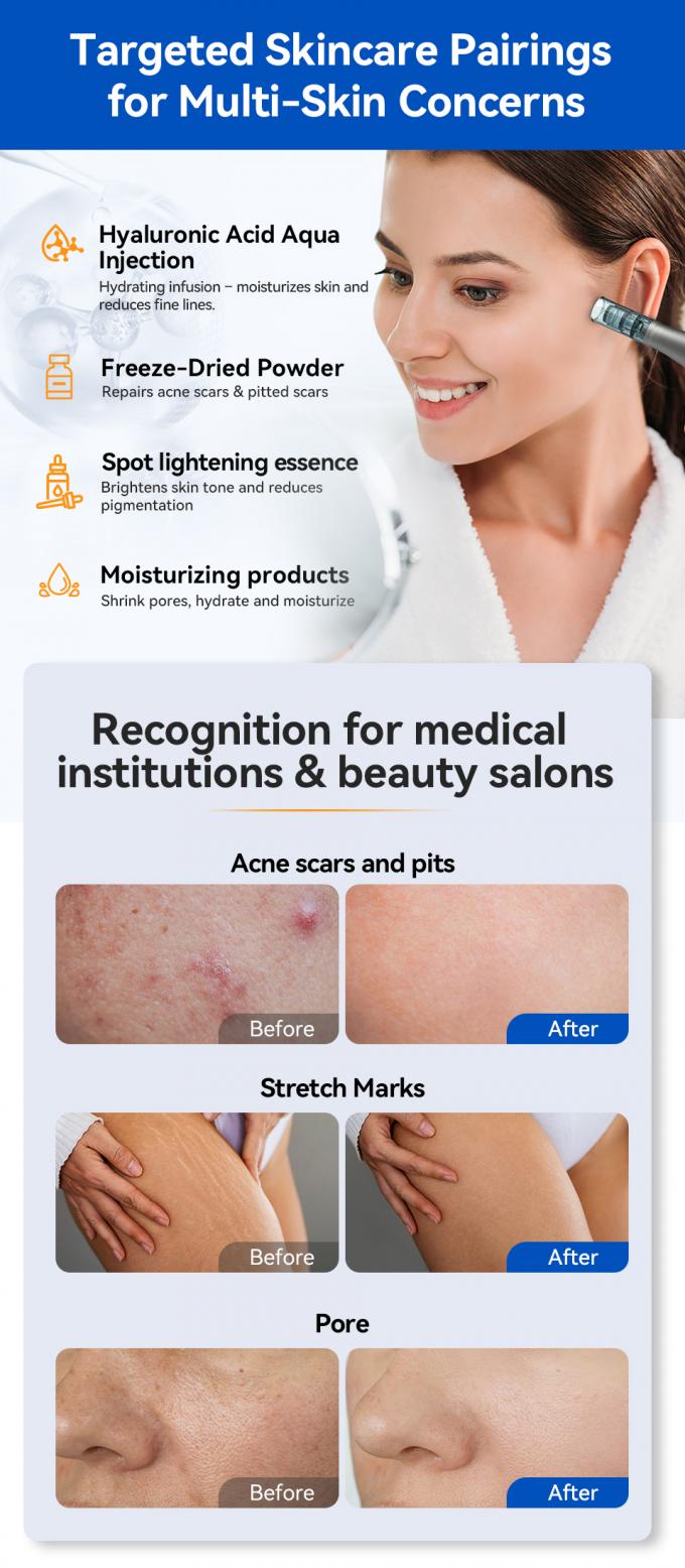 Original Marke Hydra Pen H5 MicroNeedling Derma Pen mit EMS verstellbarer Serumausgabe MTS Verringern Narben feine Linien Falten 6