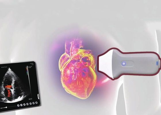 PDI WiFi Element des Radioapparat-tragbares Ultraschall-Scanner-128